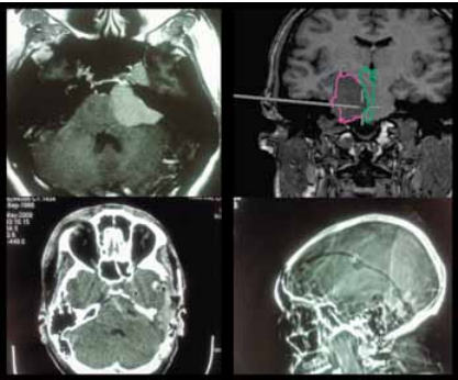 Construção do Conhecimento em Neurocirurgia