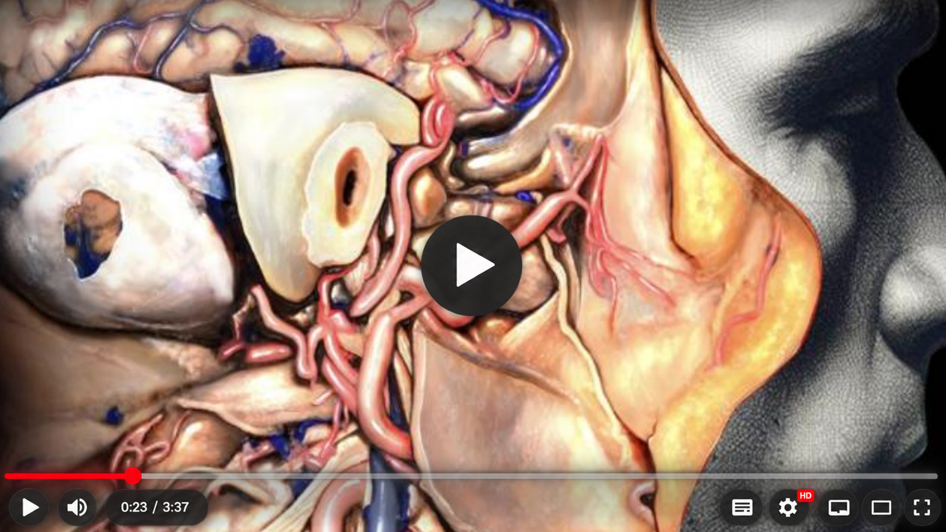 Ilustração lateral da cabeça com exposição do osso temporal, ouvido e estruturas da mandíbula em uma abordagem cirúrgica.