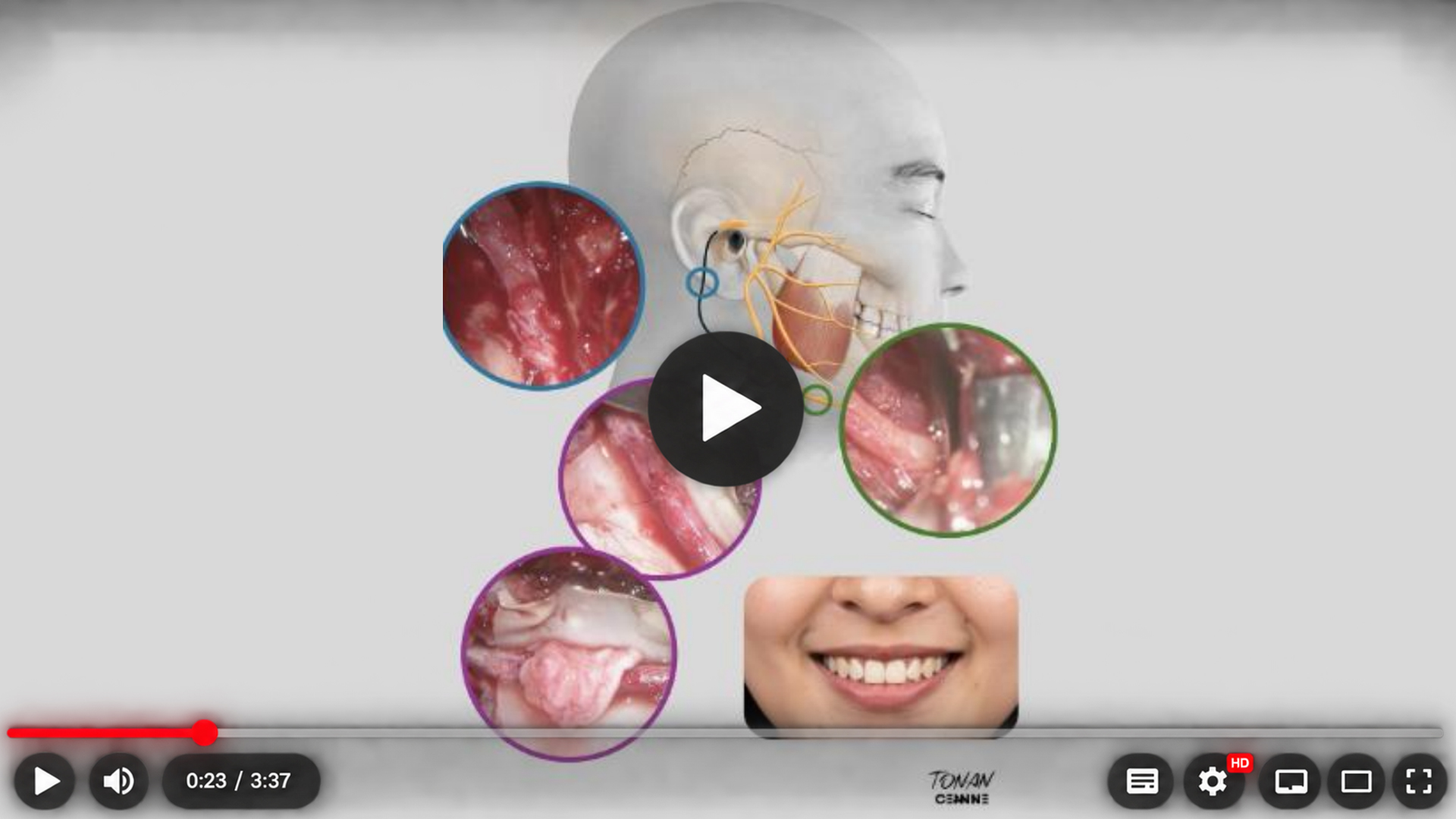Composição do resumo visual com um rosto feminino e detalhes circulares relacionados à avaliação e à reconstrução facial.